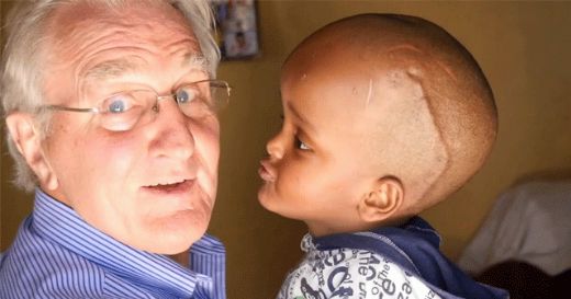 Beyin Su Toplaması Belirtileri ve Tedavisi