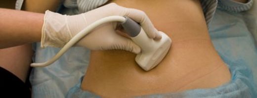 Yumurtalık Kanserinde Karında Su Toplanması